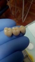 Зуботехнічна лабораторія «Стоматології від А до Я»